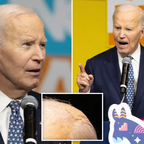 My son should’ve been the President, not me’ – Joe Biden says while sporting bandage on head