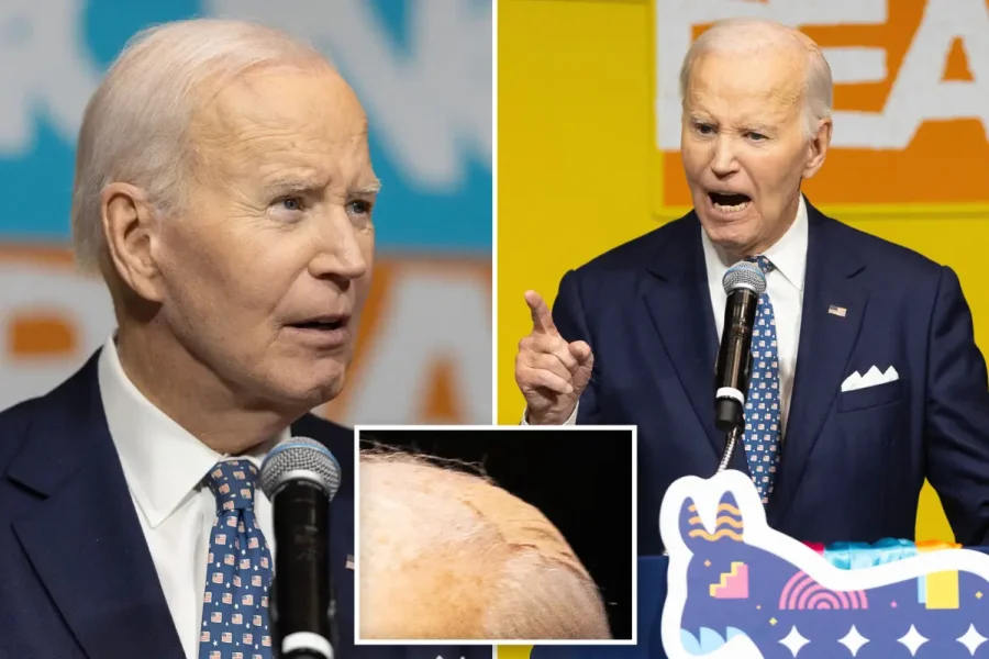 My son should’ve been the President, not me’ – Joe Biden says while sporting bandage on head