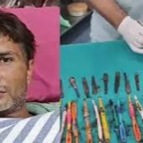 28 spoons and 19 toothbrushes found in drug addict’s stomach