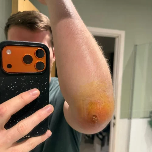 Rugby player spends 24 hours in hospital after falling in dog poo during a match